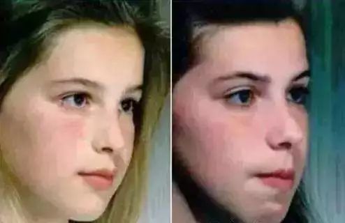 已经有报道称严重的打呼噜可以引起小儿的痴呆