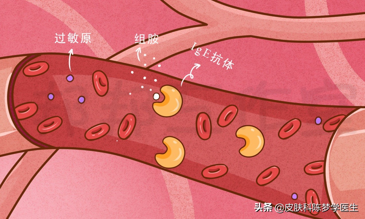 医院里面的“变态反应门诊”，到底是看什么病的？