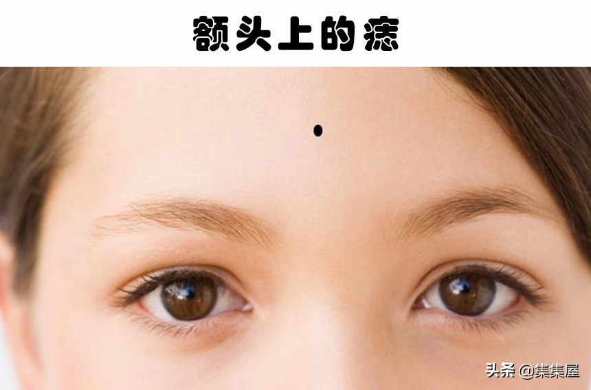 看看身体上的7个位置的痣如何显现出一个人的个性