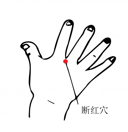 大姨妈来了却不肯走,老不干净?月经淋漓不尽的原因你该要知道