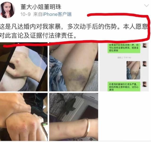 百万粉主播凡达力挺辛巴，喊话王海：你代表哪个利益集团？