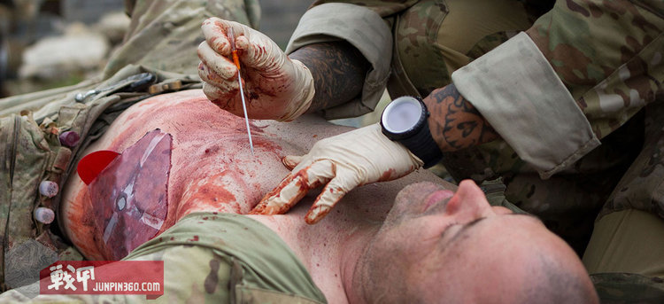 士兵练习处置开放气胸,将单向排气针阀插入伤员的胸腔开放性气胸