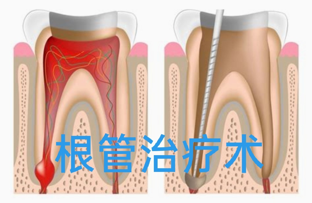 辟谣:牙痛只是小问题，一次就能治好？NO,并不是那么简单