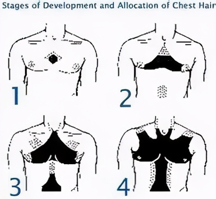 蒙氏结节怎么消除(乳晕变黑)