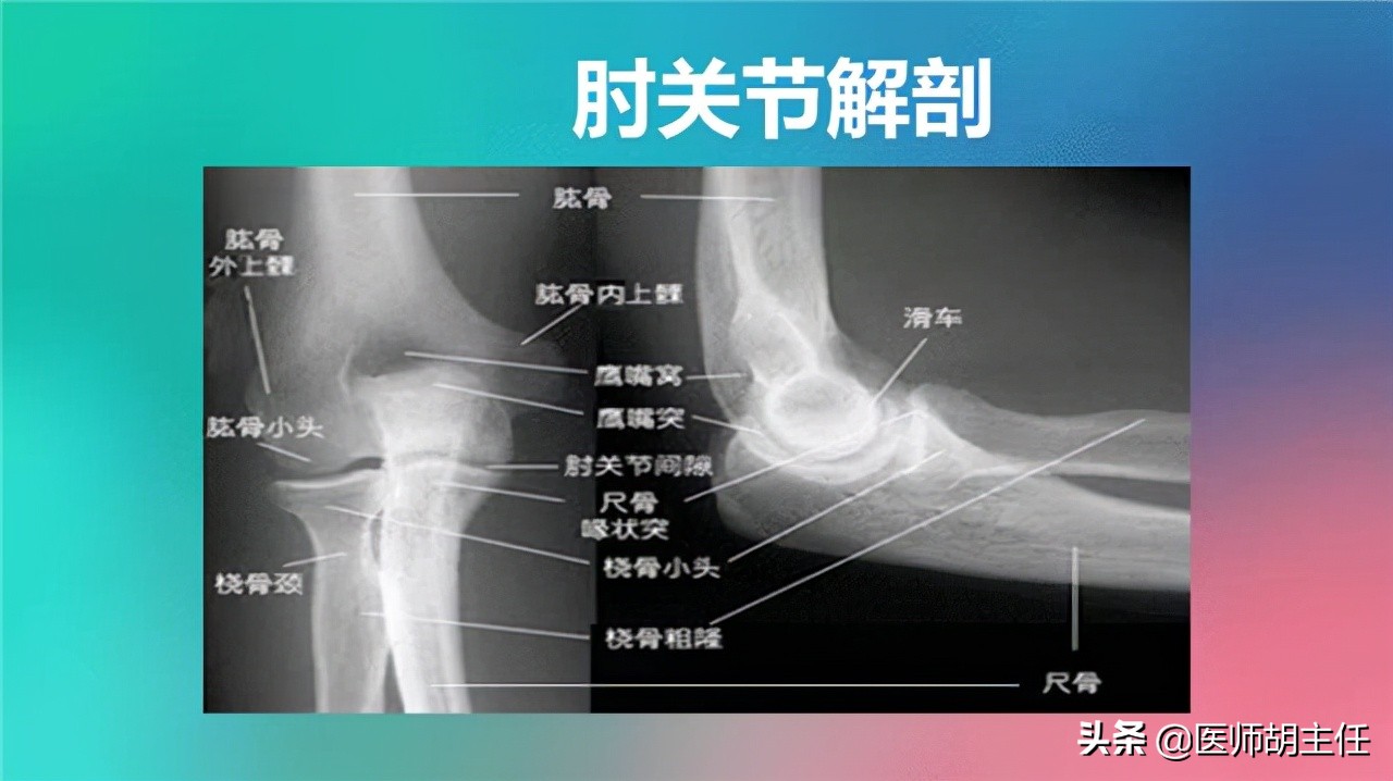 甲钴胺可以修复受损神经，能够用于这3种常见病的治疗，好用