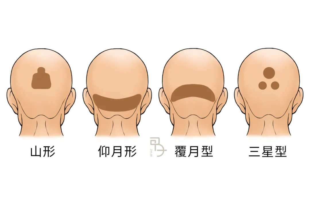 如何用脑科学的方式打开传统骨相学？