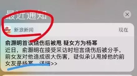 杨幂曾是俞灏明女友,在他烧伤后毅然分手?俞灏明亲自回应:假的