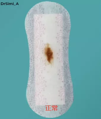 私处分泌物的6种变化，出现这3种颜色赶紧和他一起就医