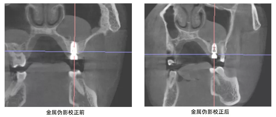 口腔CBCT这样选，才能不花冤枉钱