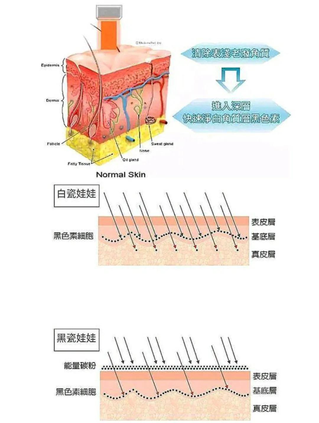 毛孔粗大还有救吗？你知的缩毛孔方法都没用