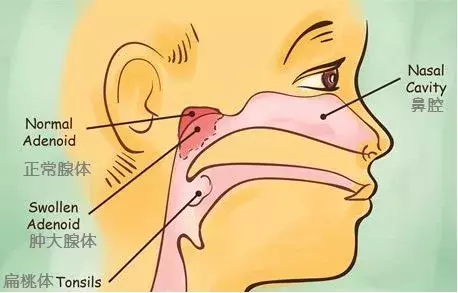 宝宝鼻塞难受,睡眠困难?知道这些小技巧,让宝宝轻松入睡!