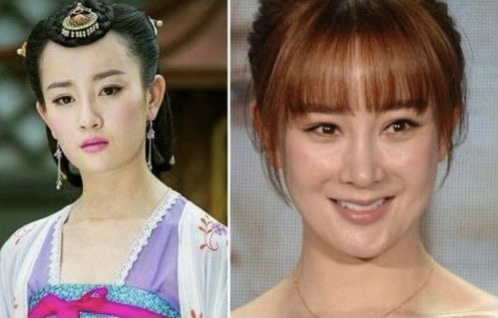 都说整容是娱乐圈“大忌”，而这10位明星，却因整容走向人生巅峰