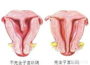 纵膈子宫不是疑难杂症，了解这些其实并不可怕