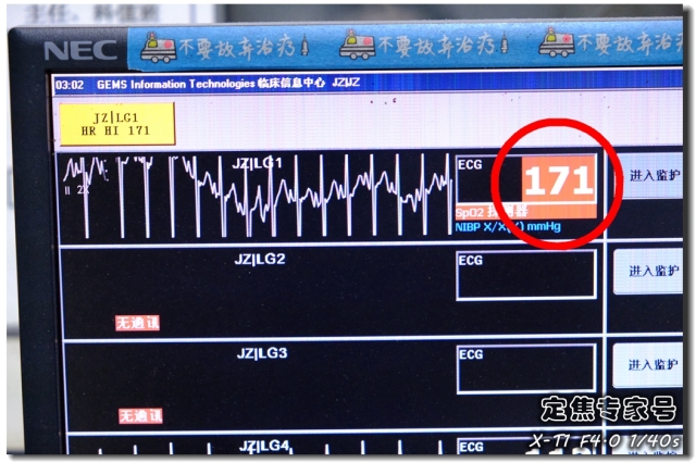 掌纹特殊不一定是异人之相，发现这种掌纹要当心