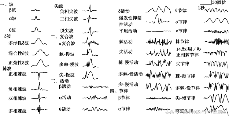 李医生思维导图,5分钟一张图,看懂脑电图临床意义
