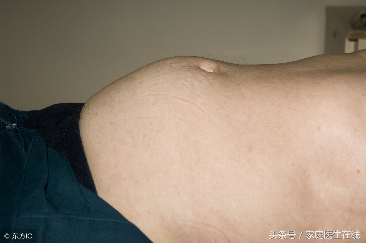 莲子去芯好还是不去芯好？营养师给出一个客观的答案