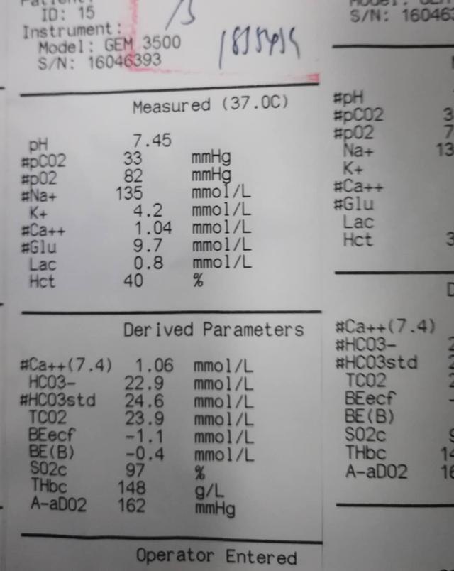 ICU中常用“十大救命神器”和收费（全），最贵一项每天8千多