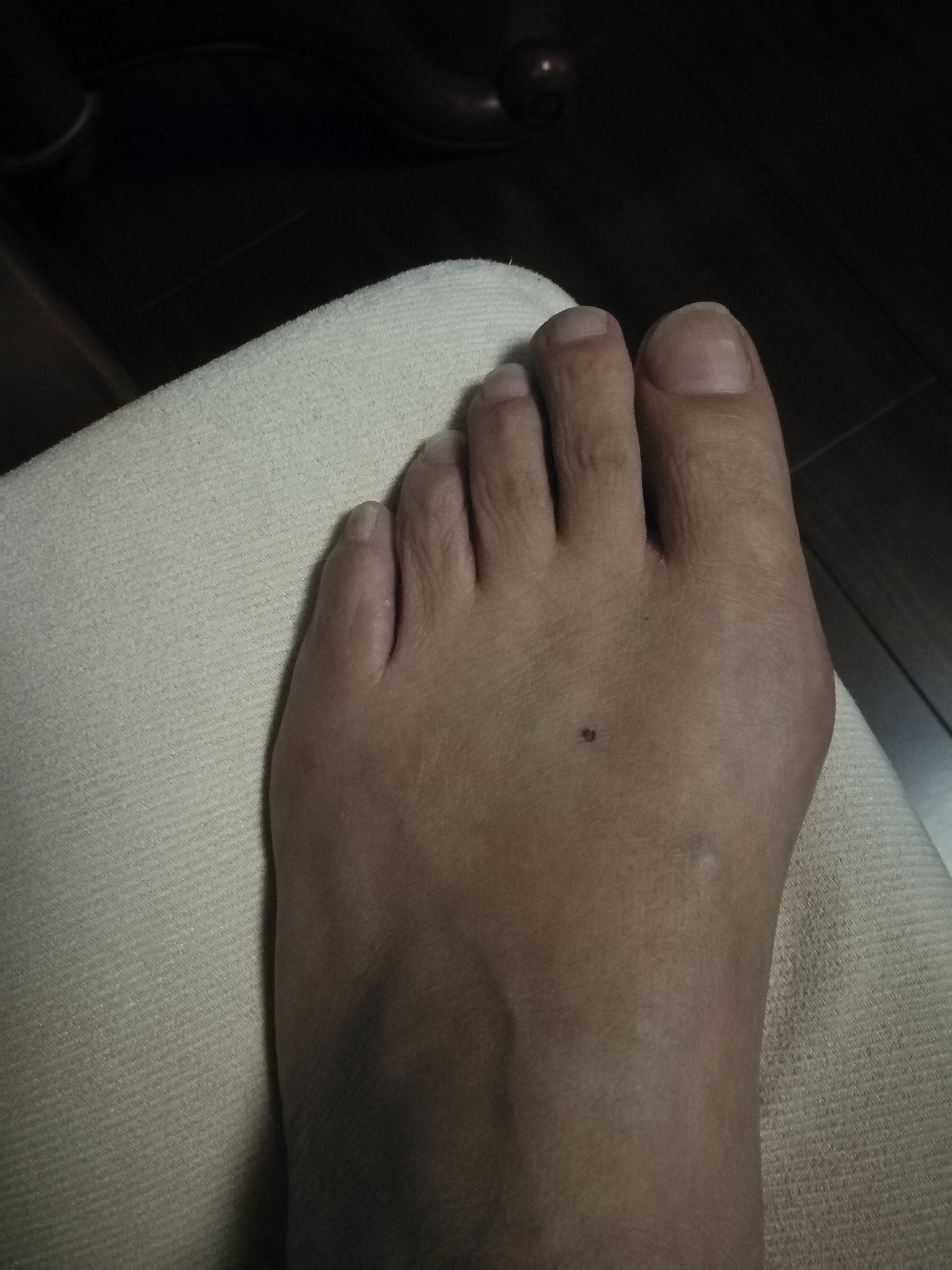 左脚踝有痣的女人好不好,工作顺畅,婚姻幸福!_达一风水网