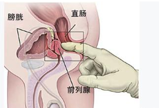 我靠！人工受孕的时候把精子取出来的方法有这些