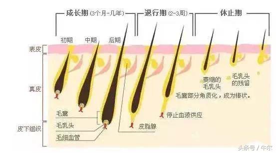 医美脱毛，首先需要了解这些要点