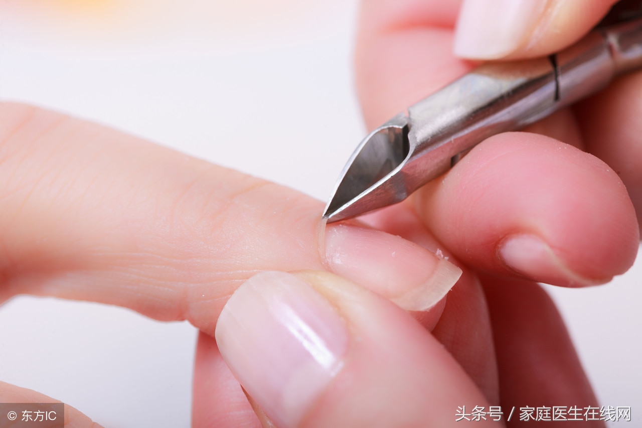 指甲盖掉了怎么办？还能长回去吗？看完你就能安心了