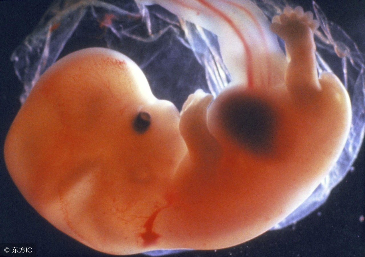 鱼头的功效和营养价值（鱼头营养高孕妇多吃有这5个好处）