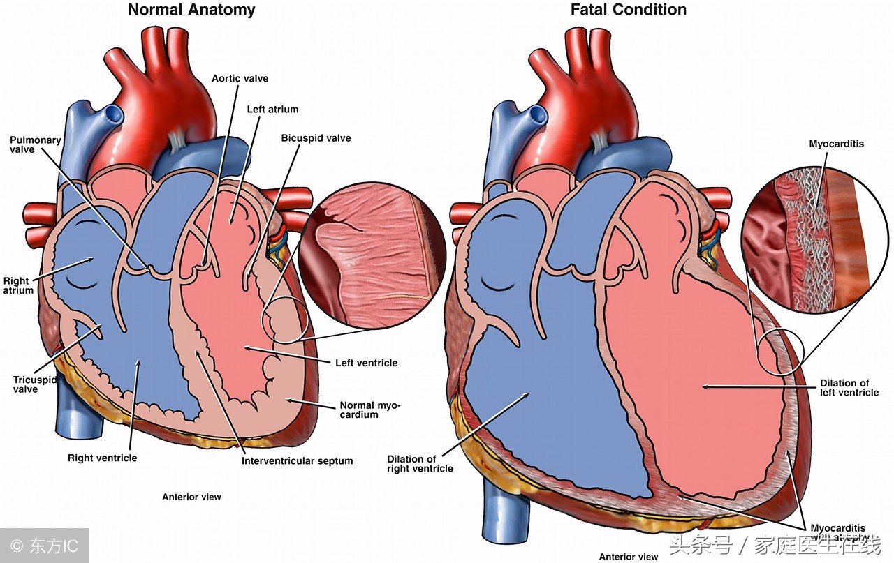 提醒：3种方法可治疗玫瑰糠疹，看你愿不愿意做