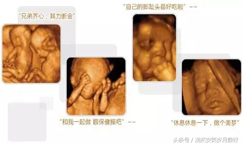 怀孕多久可以做四维彩超？