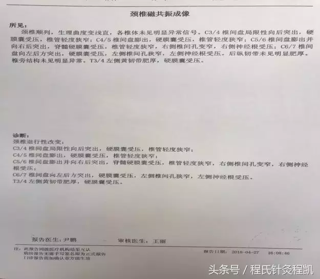 参加程氏针灸培训班，菜鸟学以致用见成效