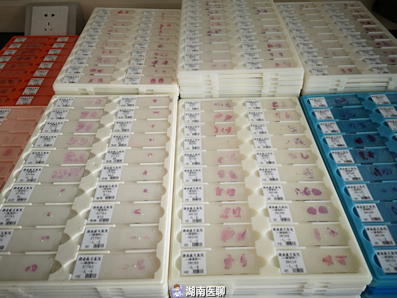 病理切片能从医院取出来吗？为什么一定要还？