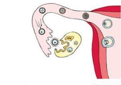 孕健康!卵巢破裂是怎么回事"春雨绵绵"-第2张图片-宝杰网