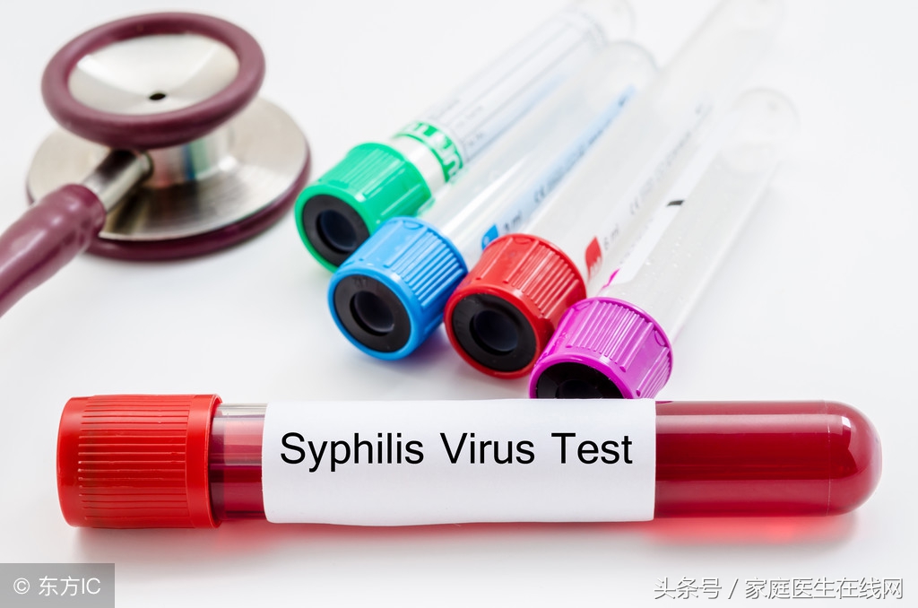 刚刚得了艾滋病的人，身体会有这些“感受”，别被传染了