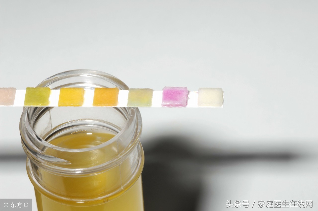 尿路感染困扰怎么办？轻松应对尿路感染的方法
