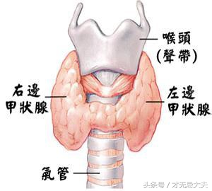 亚急性甲状腺炎，太多被误诊了！