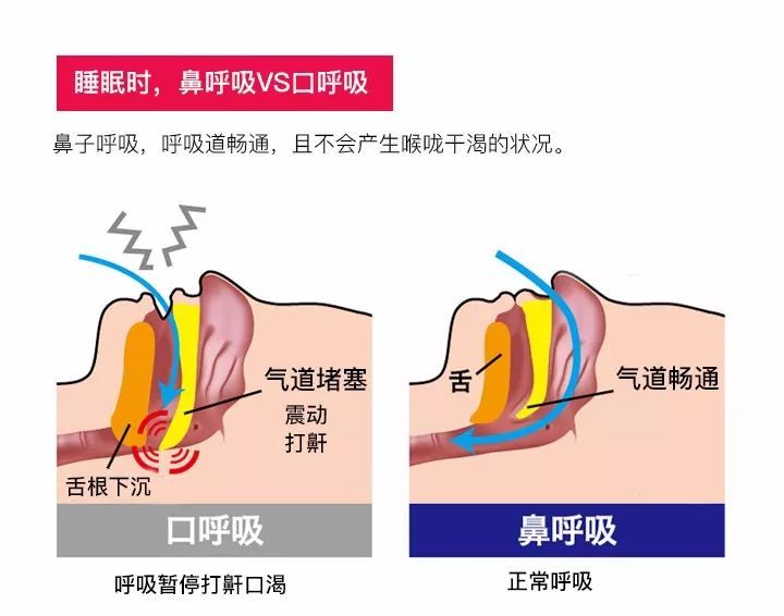 警惕！孩子张口睡觉不是好习惯，现在萌萌哒，长大猛猛哒