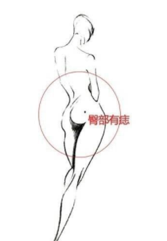 痣相分析：细数女人身上的“幸福好运痣”