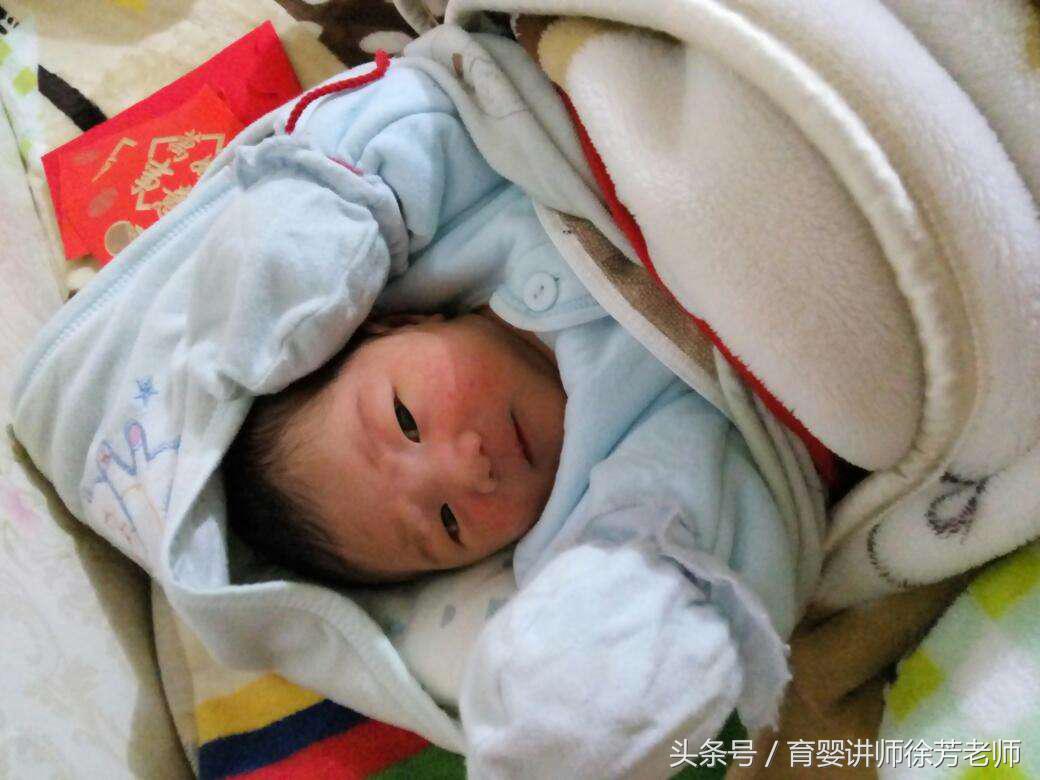 婴儿湿疹与痱子对比照（婴幼儿痱子湿疹傻傻分不清）