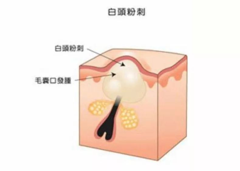 闭口能让颜值降多少？看101小姐姐就知道了……