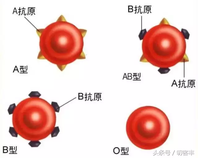 婴儿溶血（新生儿溶血是怎么回事）