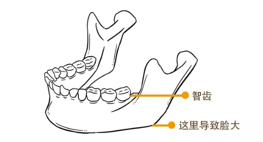 智齿疼起来要命咋解决？不拔脸会变大？看完你就门儿清