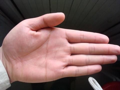 老中医手诊:看手掌颜色,健康隐患早知道