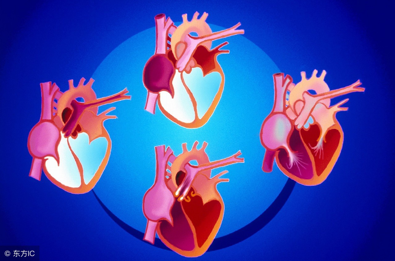绝对不能忽视心室肥大和心脏疾病的前兆。