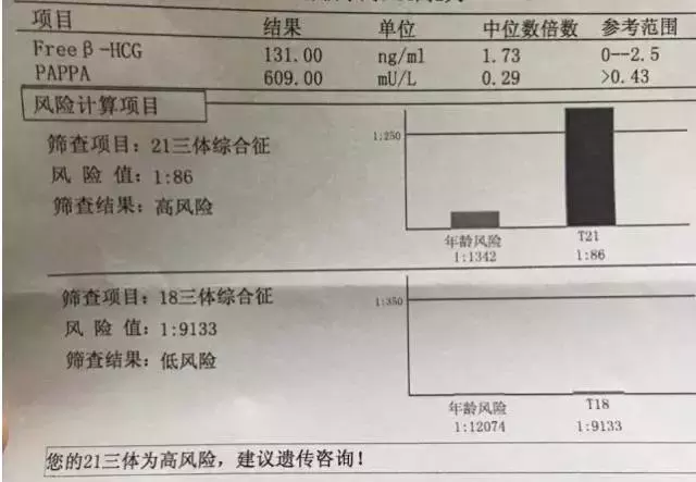 唐筛pappa什么意思 如何看唐筛检查结果？