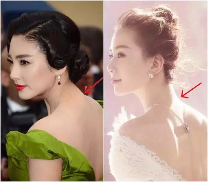 「健康」颈椎不好，健康难保！这个“夺命包”你有吗？
