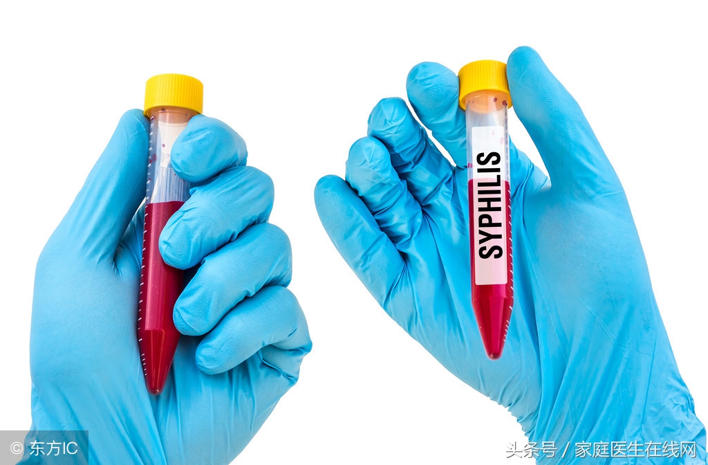 梅毒到底是怎么引起的？大多是通过这4个途径，要躲开