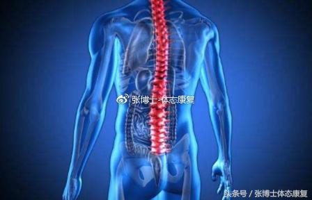 强直性脊柱炎患者运动康复指南：科学锻炼方法与注意事项