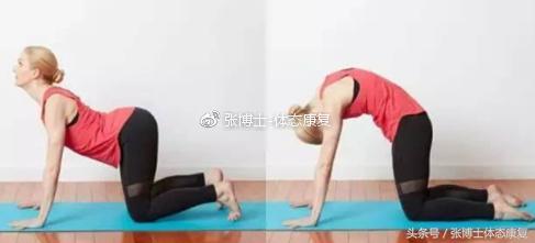 「运动康复科普」强直性脊柱炎了解一下，康复训练方法请看文章