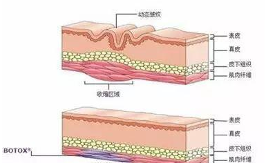 王菲500万天价打的童颜针，真的可以返老还童吗？