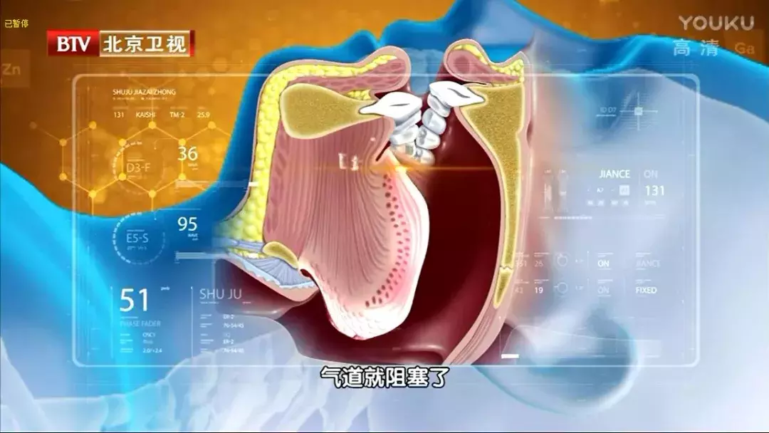 打呼噜也许是病！这6种方式可以帮你缓解