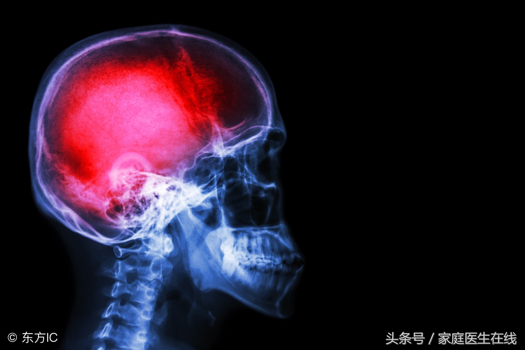 这5个信号，暗示脑中风正在逼近！为爸妈多了解一下